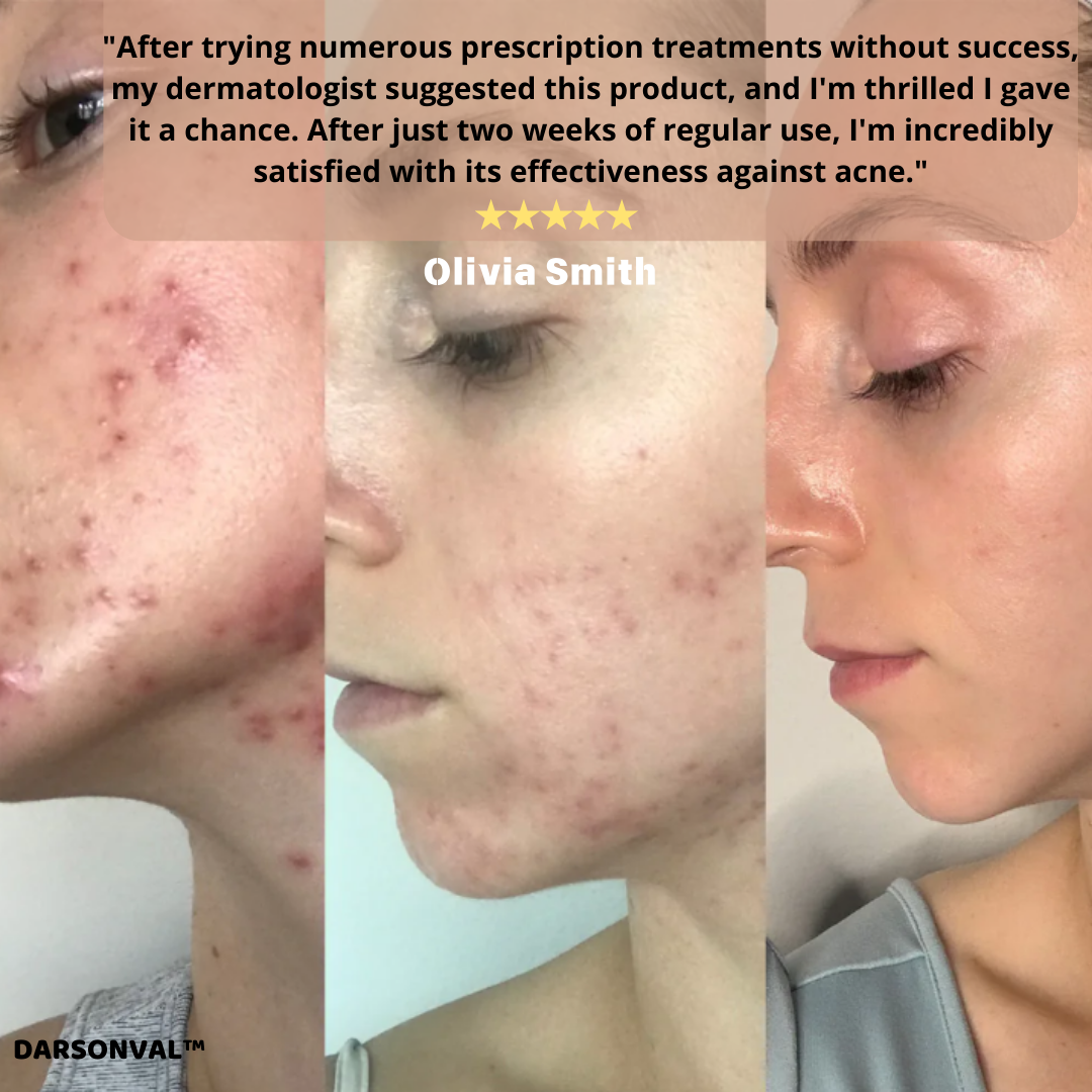 DARSONVAL™ Skin Therapy Machine