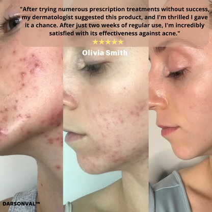 DARSONVAL™ Skin Therapy Machine