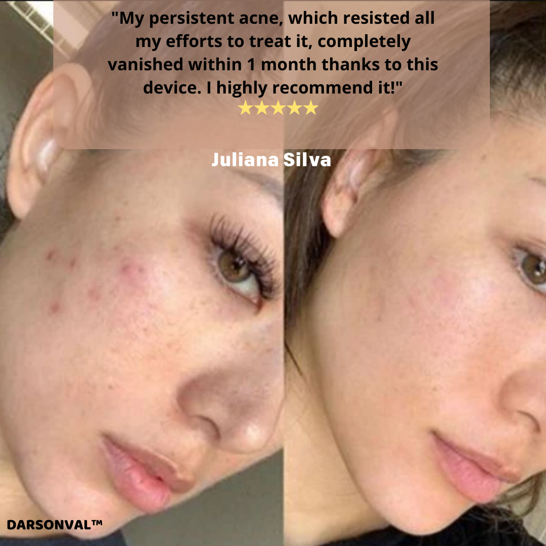 DARSONVAL™ Skin Therapy Machine