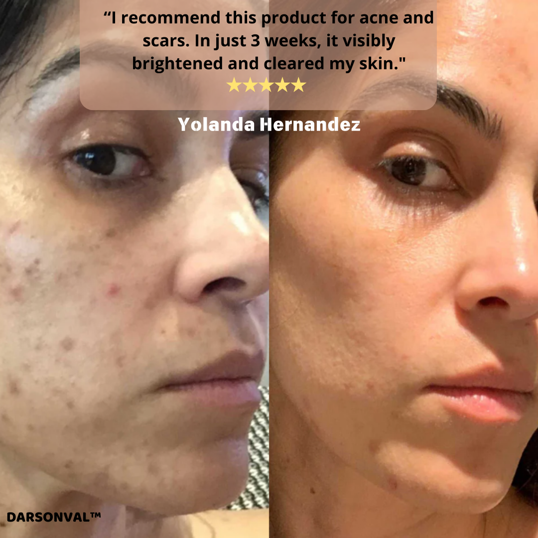 DARSONVAL™ Skin Therapy Machine