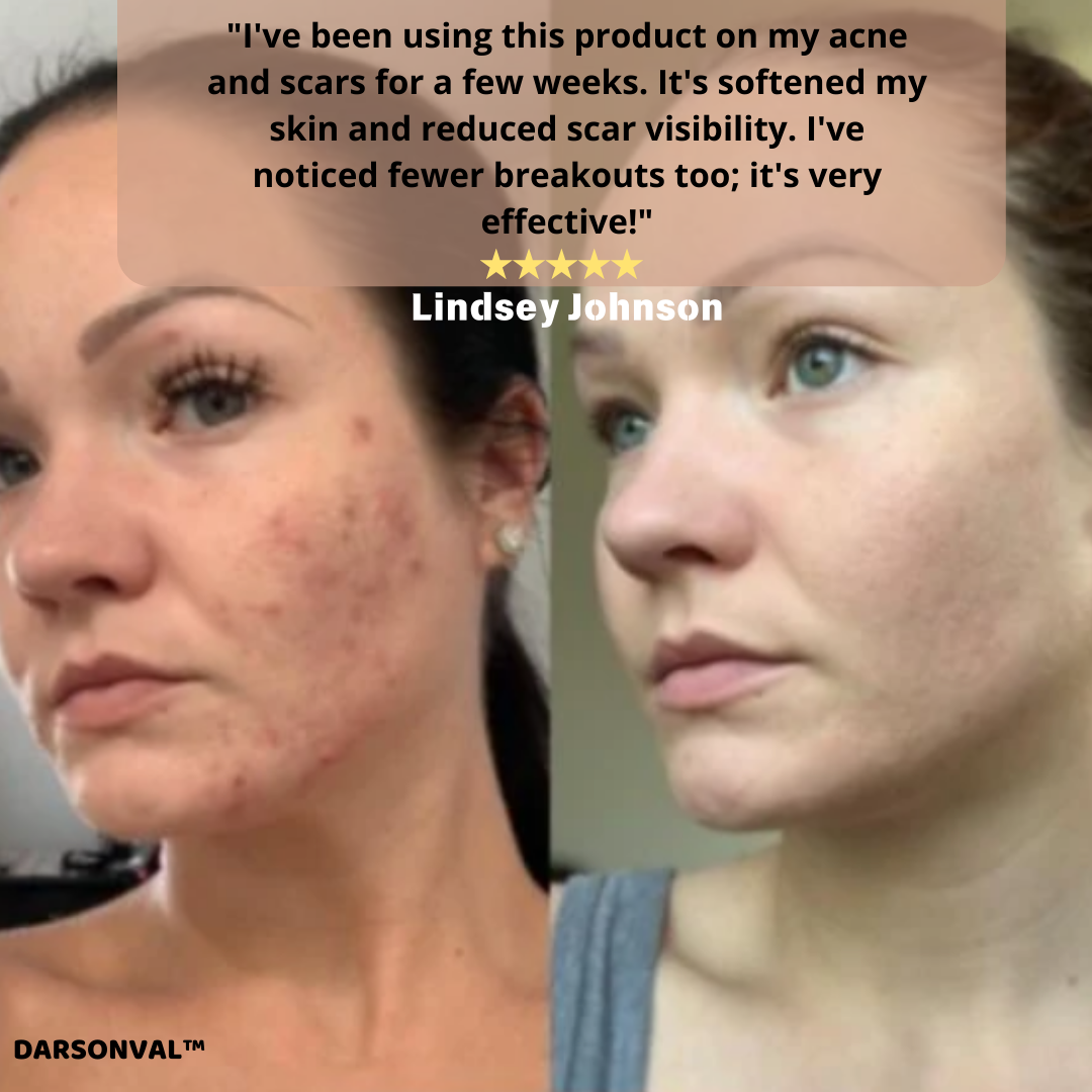 DARSONVAL™ Skin Therapy Machine